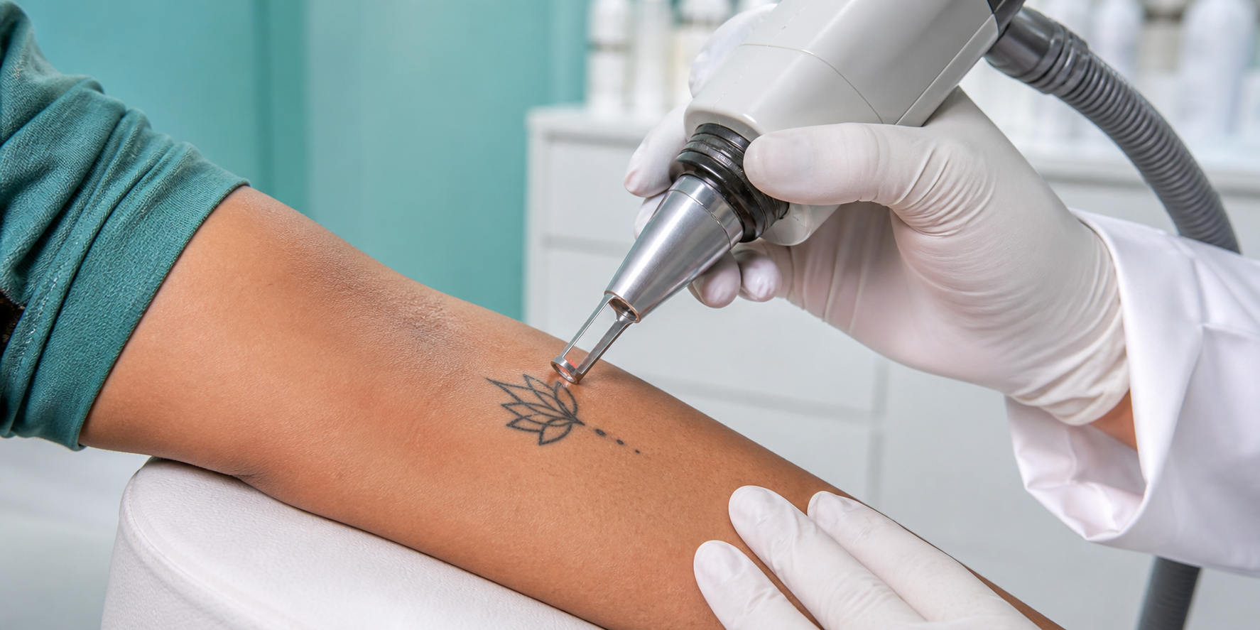 Laser Tattoo Removal