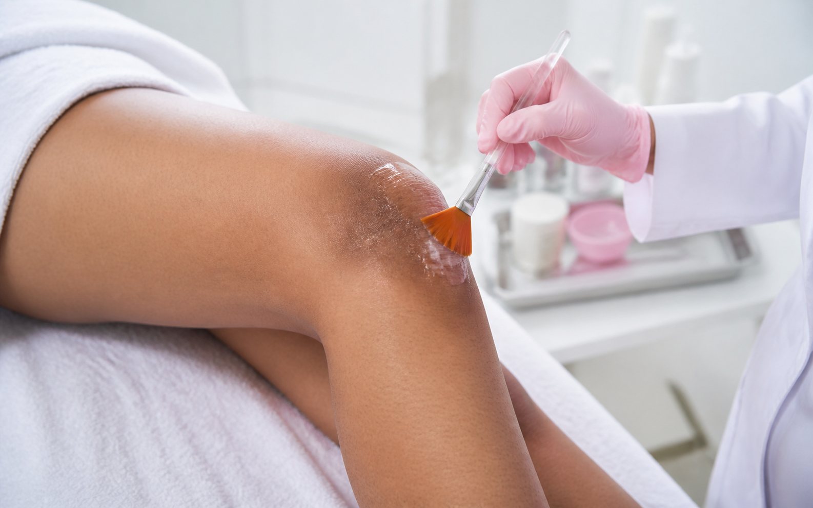 Knee, Elbow & Neck Peel