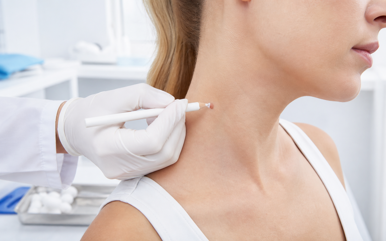 Skin Tag Removal